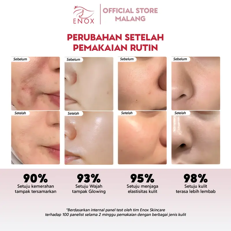 Enox Skincare - Brightening Glow Up Serum Anti Aging Mencerahkan Menyamarkan Kerutan dan Mengurangi Flek Hitam 2