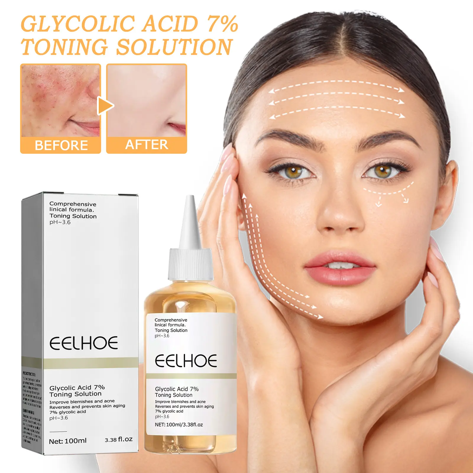 Glycolic Acid 7% Toner - Removes acne, closes mouth, lighens acne, restores skin, moisturizes skin Skincare Comfort   Toner
