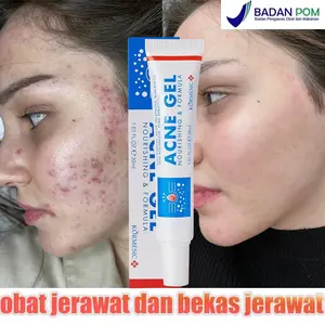 【BPOM】Salep Acnes Penghilang Jerawat dan Bekas Jerawat – Obat Totol Jerawat Herbal Krim jerawat Obat Jerawat Ampuh Salep Obat Jerawat Moisturizer Wajah Wajah