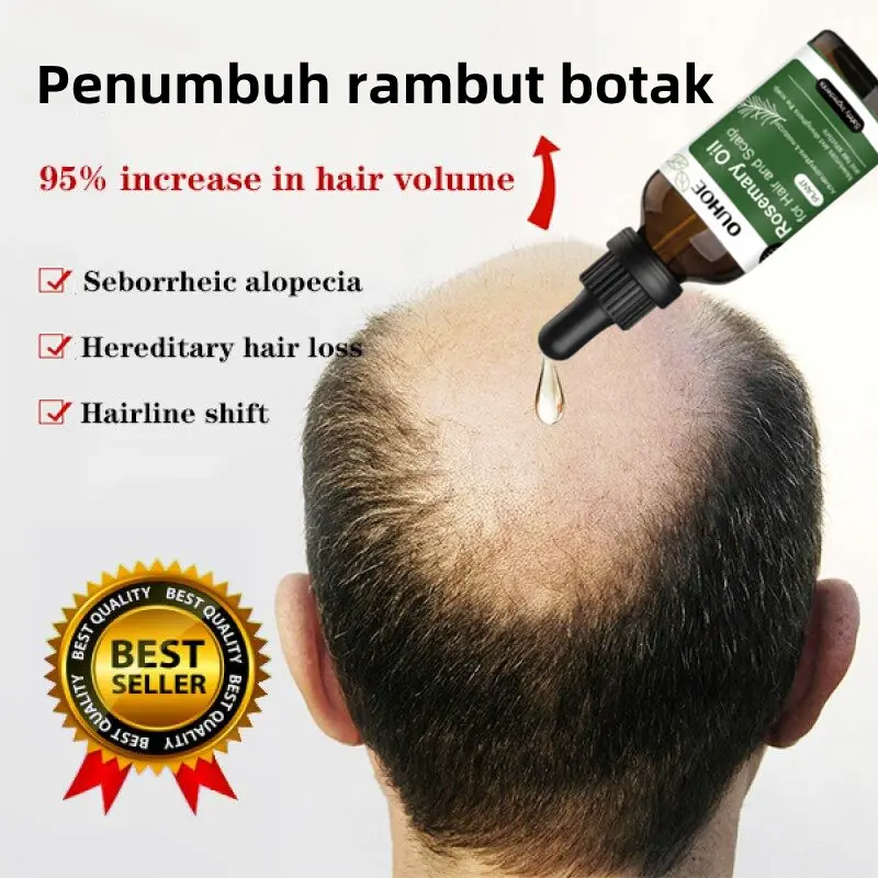 Penumbuh rambut cepat Serum rambut rontok Hair tonic rambut rontok Penumbuh rambut botak Penumbuh Rambut Perawatan