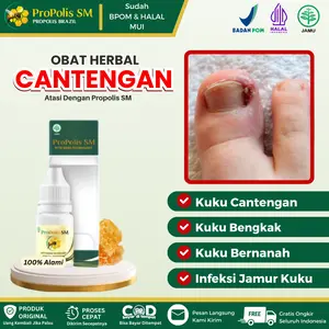 Propolis SM Mengatasi Kuku Cantengan, Infeksi Jamur Kuku, Kuku Bengkak, Atasi Cantengan Kuku dan Tangan Dengan Propolis SM HALAL BPOM
