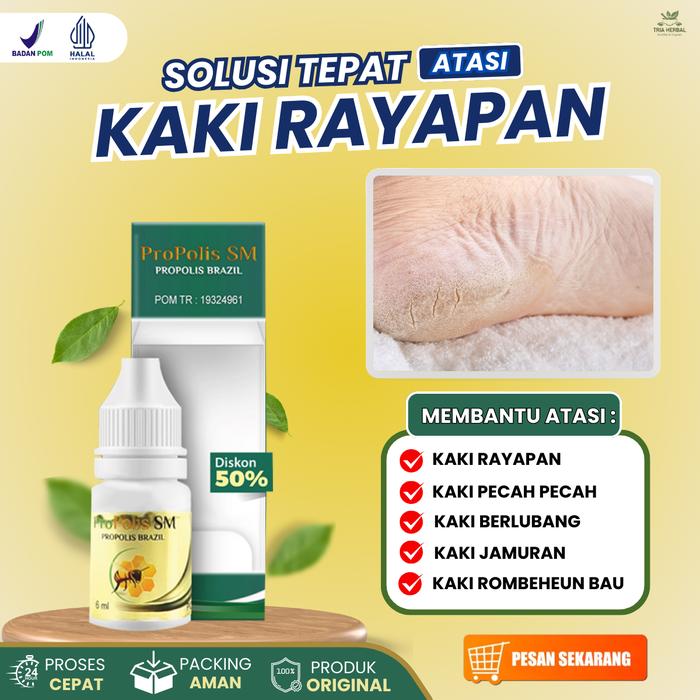 Gambar Propolis SM Cairan Oles Atasi Kaki Rayapan, Kaki Berlubang, Kaki Bolong Rorombeheun, Kaki Jamuran, Kaki Pecah Pecah, Penghilang Kutil Di Kaki Dengan Propolis SM dari Tria Herbal Store Kota Administrasi Jakarta Pusat Tokopedia