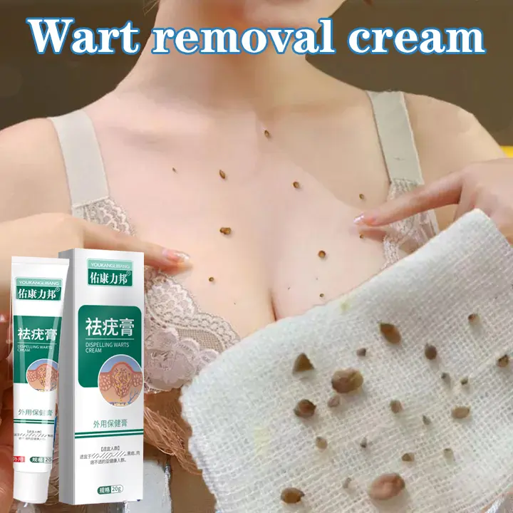 Skin tag remover Wart removal 20g mole remover  Painless corn remover Genital warts Remove cream