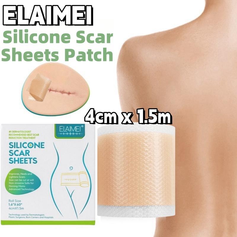 ⭐️ORI⭐️ELAIMEI Silicone Scar Sheets Patch Penghilang Keloid Tambalan Stretch Mark Surgery Scar Removal Silicone Repair Tape 4cm x 1.5m - Ready 1