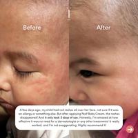 Gambar NAIF BABY - Baby Cream / Nurturing Cream - 75ml / kirim untuk Bayi / krim eczema dari Naif Care Indonesia Kota Administrasi Jakarta Barat 5 Tokopedia