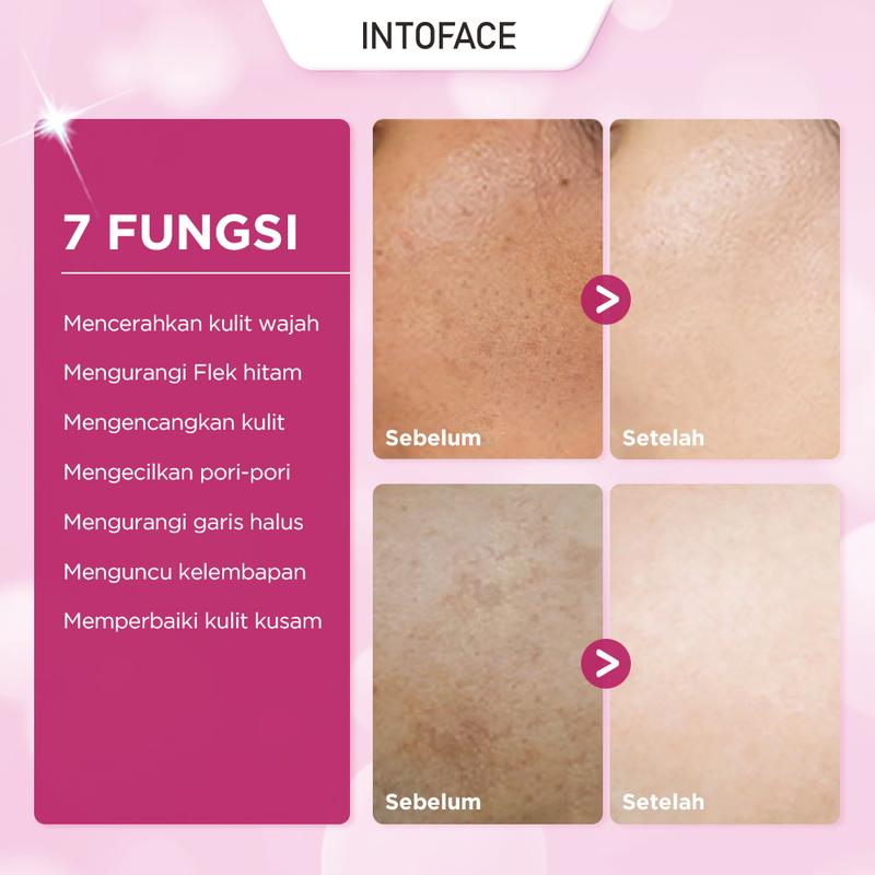 INTOFACE MSH 10% Niacinamide Brightening Moisturizer Cream B3 B5 Smywhite 377 Day & Night Cream Whitening Glowing Moisture Gel Pemutih Wajah krim pelembab pemutih Krim untuk kulit sensitif 30g 6