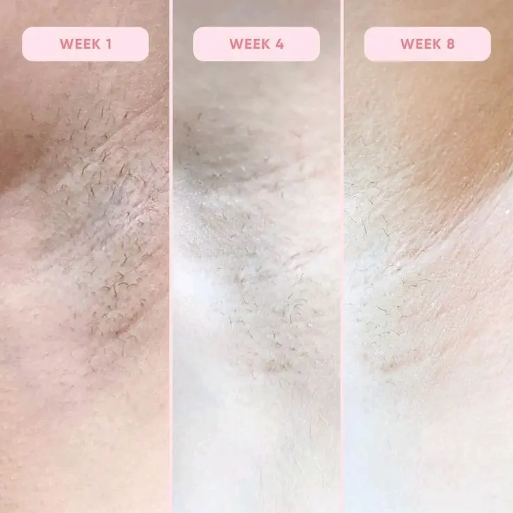 [RIKMAMU] 25ML CYPERUS ROTUNDUS OIL/HAIR REMOVAL/PERONTOK RAMBUT KETIAK 3