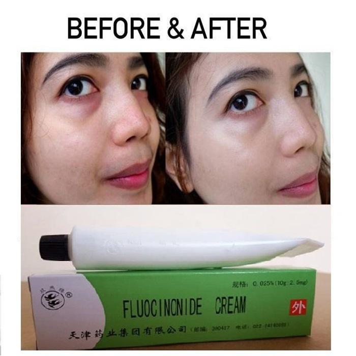 CREAM hijau ORIGINAL cream muka flek 1