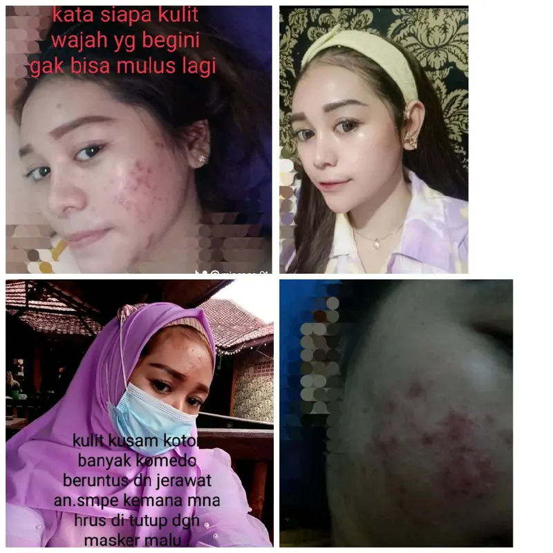 paket whitening kulit sensitif 1