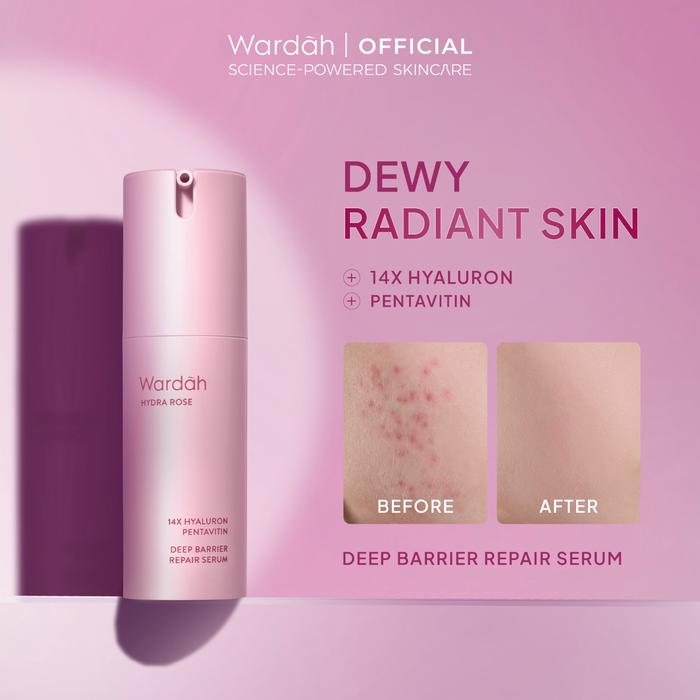 Gambar WARDAH Hydra Rose 14X Hyaluronic Pentavitin Deep Barrier Repair Serum 30 ml - Serum dengan Allantoin - Perawatan Wajah untuk Kulit - Resilient Skin - Skincare - 30 ml dari wardahbeautyid Kab. Bekasi Tokopedia