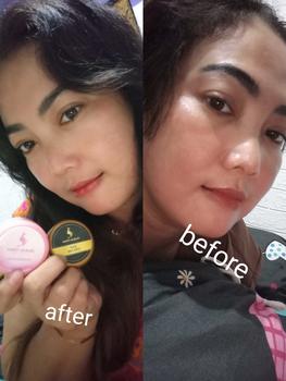 Product Review of JASKIN SKINCARE PAKET LENGKAP from J**Y ** 0