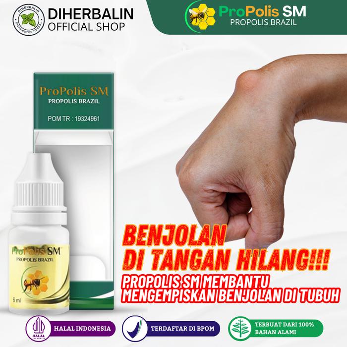 Gambar ProPolis SM Obat Kista Ganglion Benjolan Di Tangan dari Diherbalin Shop Kota Administrasi Jakarta Barat Tokopedia