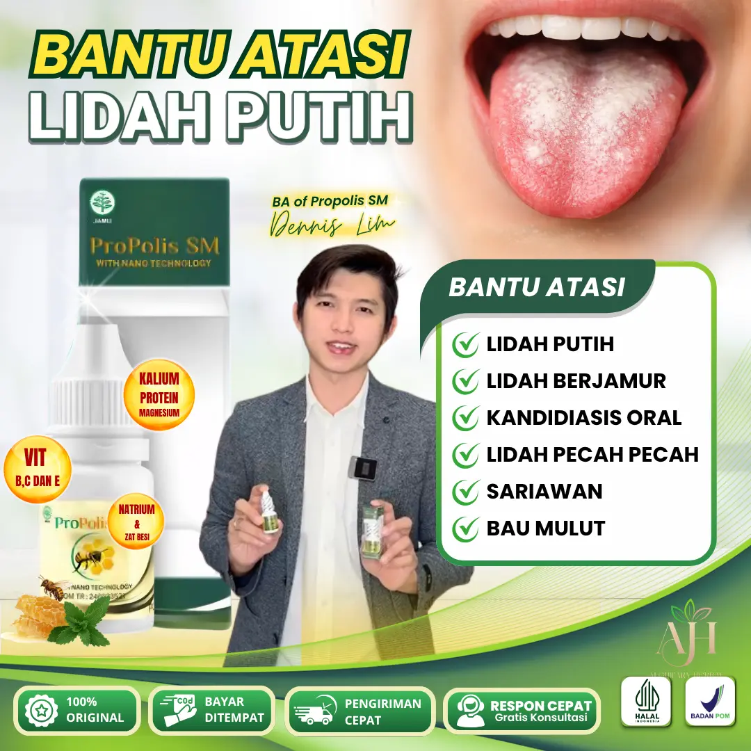 Propolis SM Untuk Lidah Putih Kandidiasis Oral, Pembersih Bercak Putih Tebal Infeksi Jamur Lidah PALING EFEKTIF Namun Tergantung Kondisi Tubuh