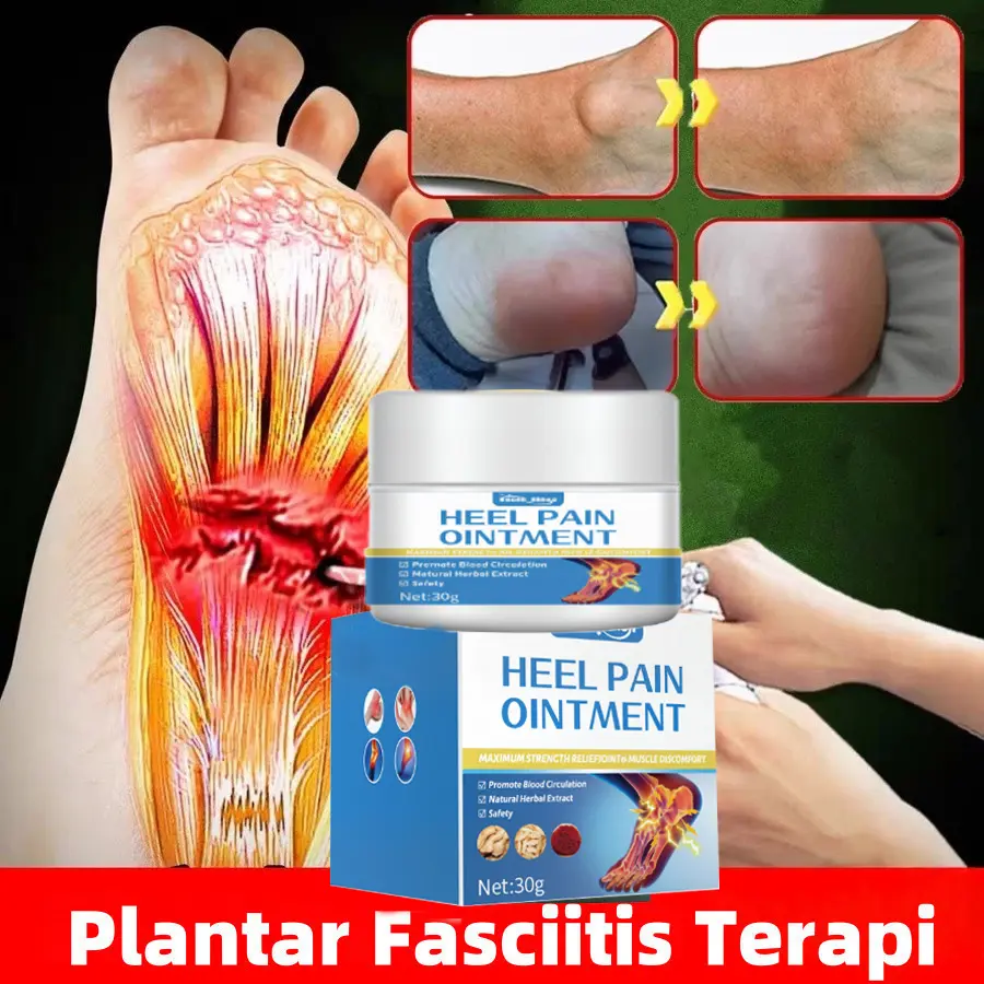 Obat Sakit Tumit Krim Plantar Fasciitis Terapi Obat Kaki Bengkak Salep Tumit Sakit Paling Ampuh Obat Sakit Telapak Kaki