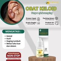 Gambar Keloid Daging Tumbuh Daging Jadi Penghilang Keloid Luka Tindik Di Telinga Bekas Operasi Penghilang daging tumbuh, keloid Menahun, Propolis sm dari Herbalthy Store Kota Administrasi Jakarta Barat 1 Tokopedia