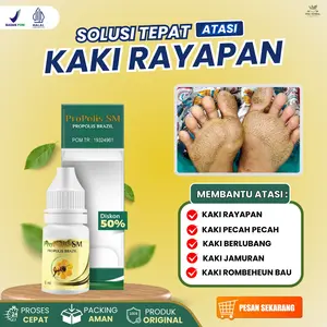 Cairan Tetes Penghilang Rayapan Pada Telapak Kaki, Atasi Kaki Berlubang, Kaki Bolong, Kaki Jamuran, Kaki Pecah Pecah, Penghilang Luka di Kaki Dengan Propolis SM
