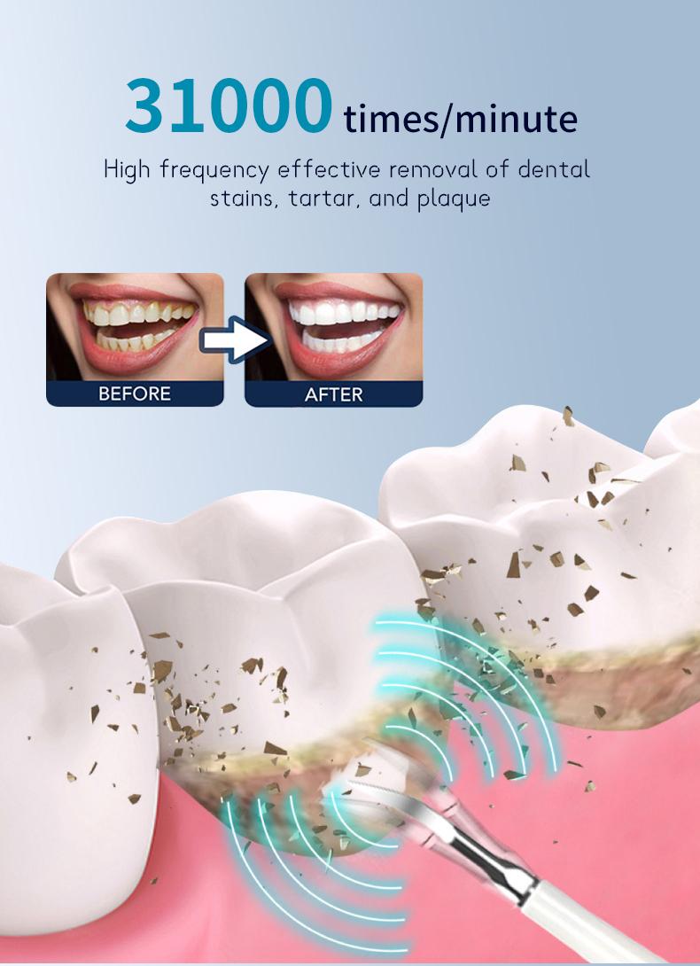 Product Introduction of Pembersih gigi multi-fungsi, dapat diisi ulang, portabel, pemutih dan pemoles gigi 4