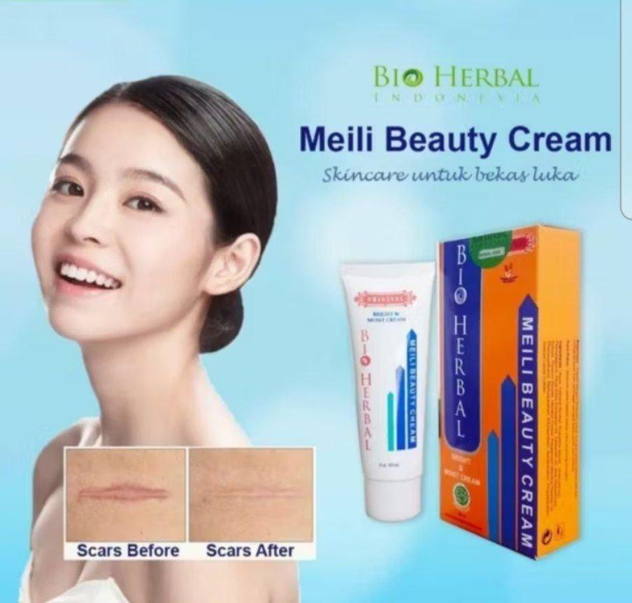Penghilang bekas luka hitam koreng Salep penghilang bekas luka 40g Menghilangkan Bekas luka koreng Bekas gigitan nyamuk Bekas luka di kaki Keloid bekas Stretch mark Pembakaran Bekas Luka