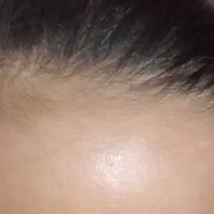 Lab On Hair Anti Hair Fall Ampoule Serum - Hair Oil Serum Vitamin Rambut Growth Rambut Anti Rontok Kering Bercabang Mempercepat Pertumbuhan Rambut Penumbuh Rambut Water Base Minyak Rambut dengan PDO + Biotin + Ginger