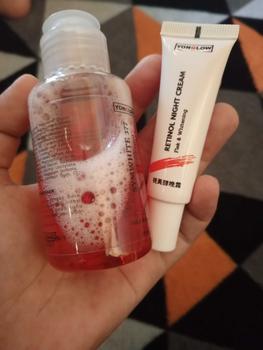 Product Review of Yonglow Paket 2in1 Flek Noda Bintik Hitam Membandel Melasma Hiperpigmentasi Salep Malam Toner Darkspot Symwhite 377 Tranexamic Acid Pemutih Wajah Glowing BPOM from B**0 1