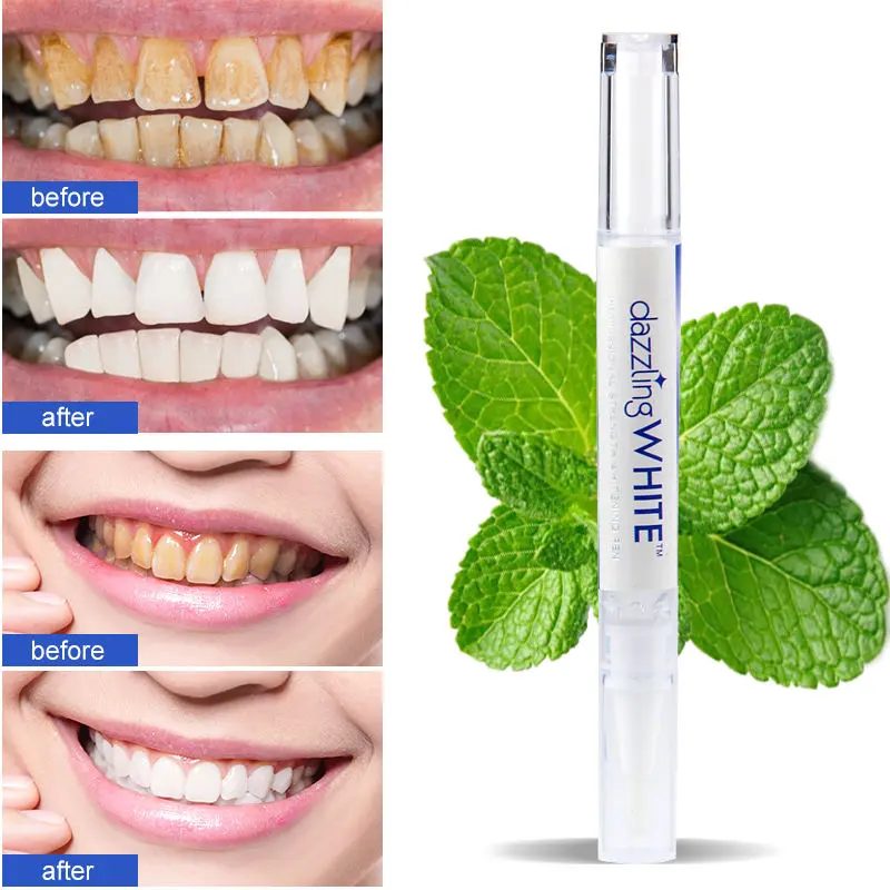 Bye-bye Gigi Kuning! Senyum Cerah Instan dengan Dazzling Whitening Pen 5
