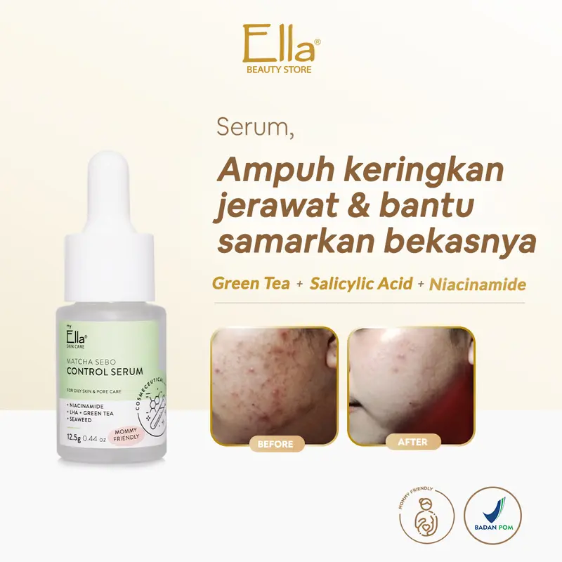 Ella Skincare Serum Matcha Sebo Control with Green Tea, BHA, Niacinamide - Mengeringkan Jerawat dlm 3 Hari 0