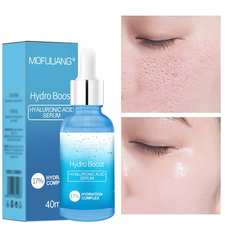 Facial Essence, Improves Shine, Firms, Shrinks Pores, Removes Wrinkles, Smoothes Fine Lines, Repairs, Moisturizes, Suitable For Skin Care skin  tag  remover niacinamide serum  tranexamic  acid hyaluronic  acid  serum