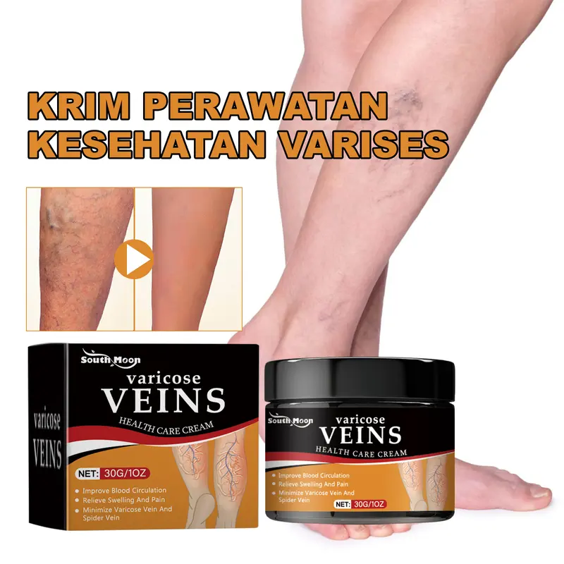 South Moon Krim Varises Vena Bulan Selatan mengurangi rasa sakit, bengkak, varises, vena kaki dan memperbaikinya, obat varises merah 0