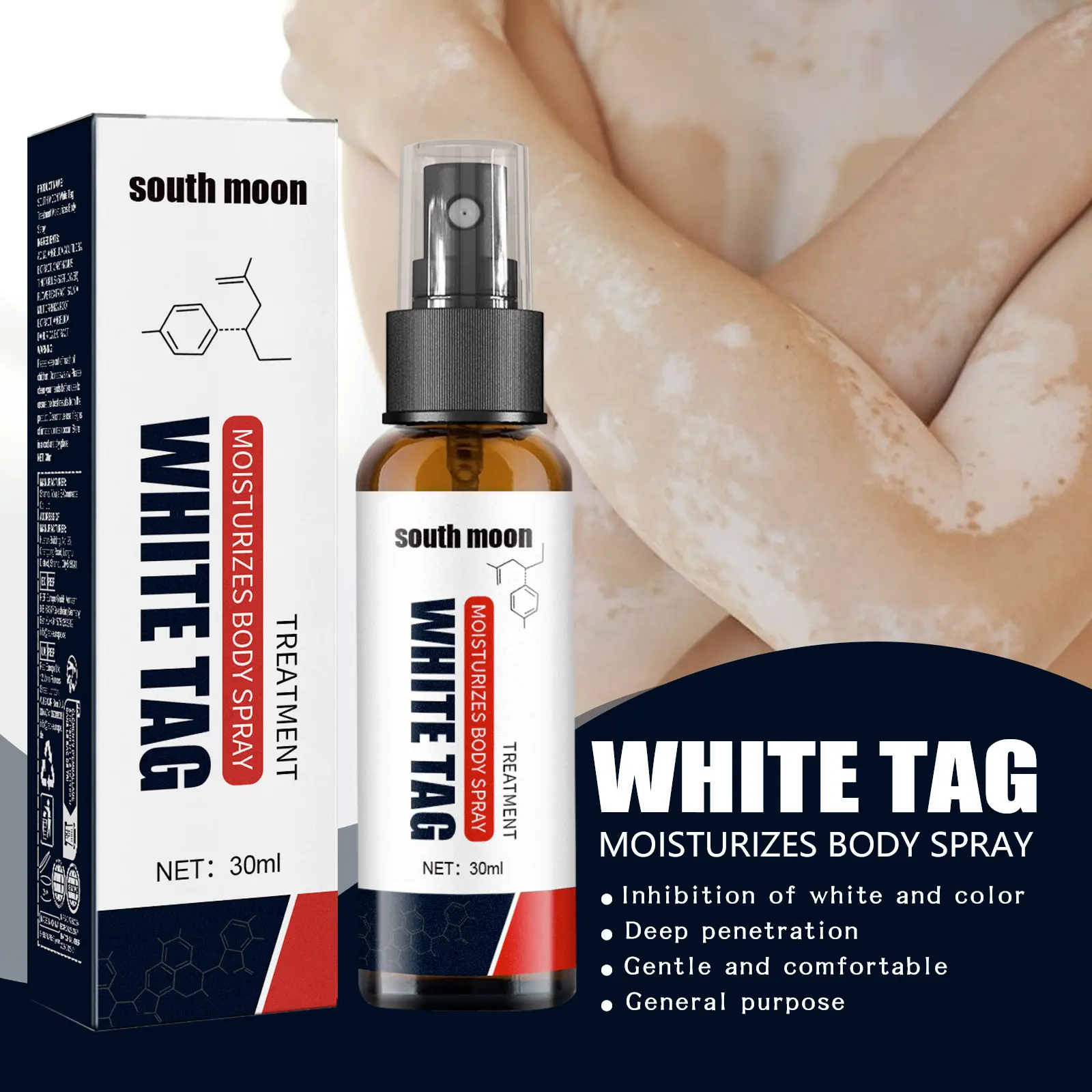 White Tag Remover Spray Moisturizes Moisturizing Reduces White Spots Body Vitiligo Removal Relief Spray White Spot Desalination Vitiligo Treatment Cream Vitiligo Cover Ointment 30ml Perawatan Kulit Berjamur dan Panu Penghilang Leukoplakia Vitiligo