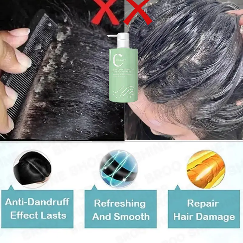 Shampoo Penghilang Ketombe Shampoo Psoriasis Anti Ketombe Dan Gatal Garam Laut Sampo Ketombe Shampoo Kutu Rambut Pengobatan Tungau Kulit Kepala Kering Dan Ketombe Mengontrol Minyak 1