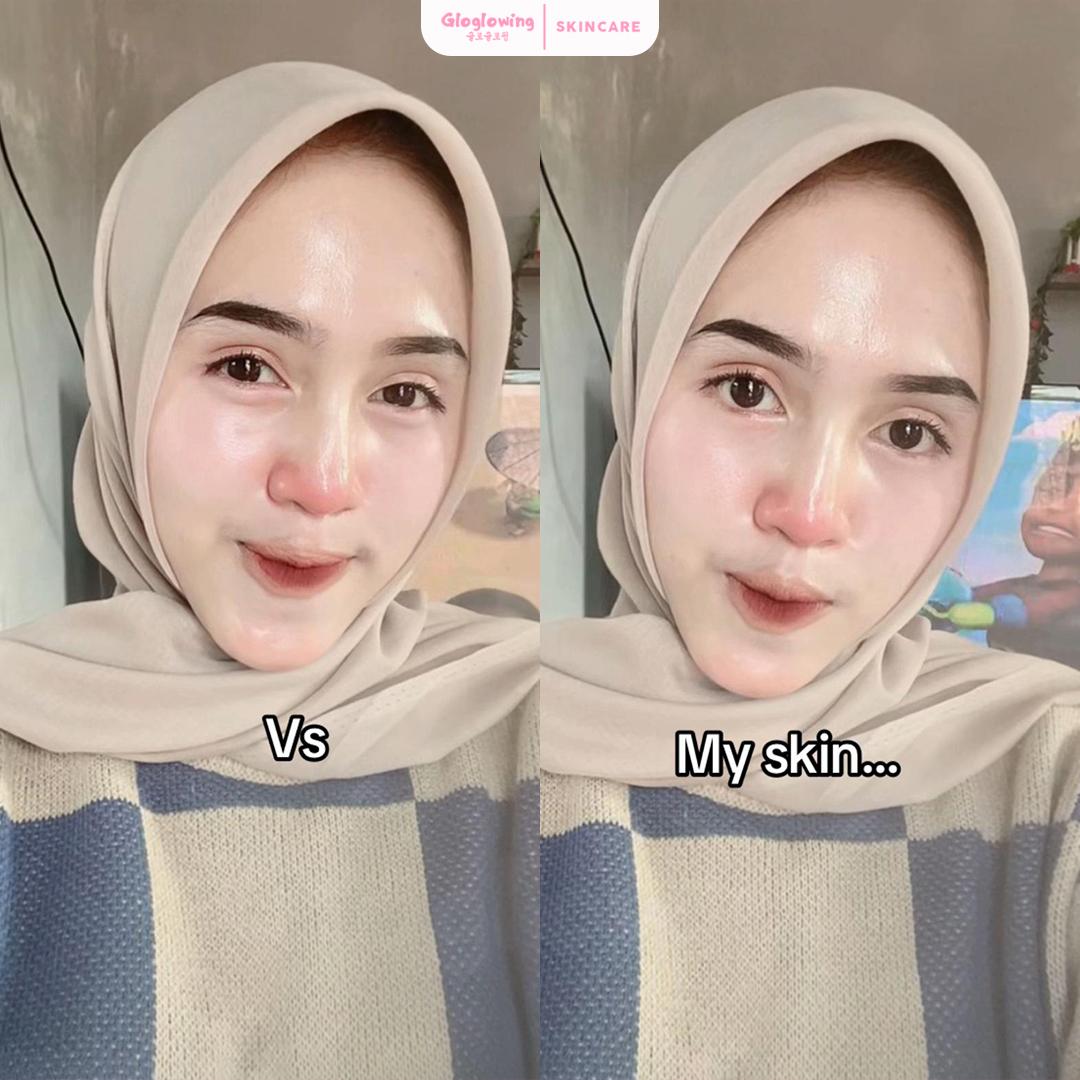 DOSIS 2 - Paket Retinol Booster Cysteamine / Antioxidant DOSIS 2 - Paket Retinol Booster Cysteamine / Antioxidant