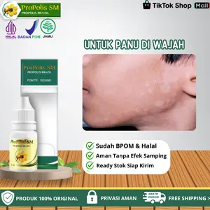 Oles Panu Di Wajah Bercak Putih Di Wajah Dan Warna Kulit Tidak Merata Dengan Propolis SM