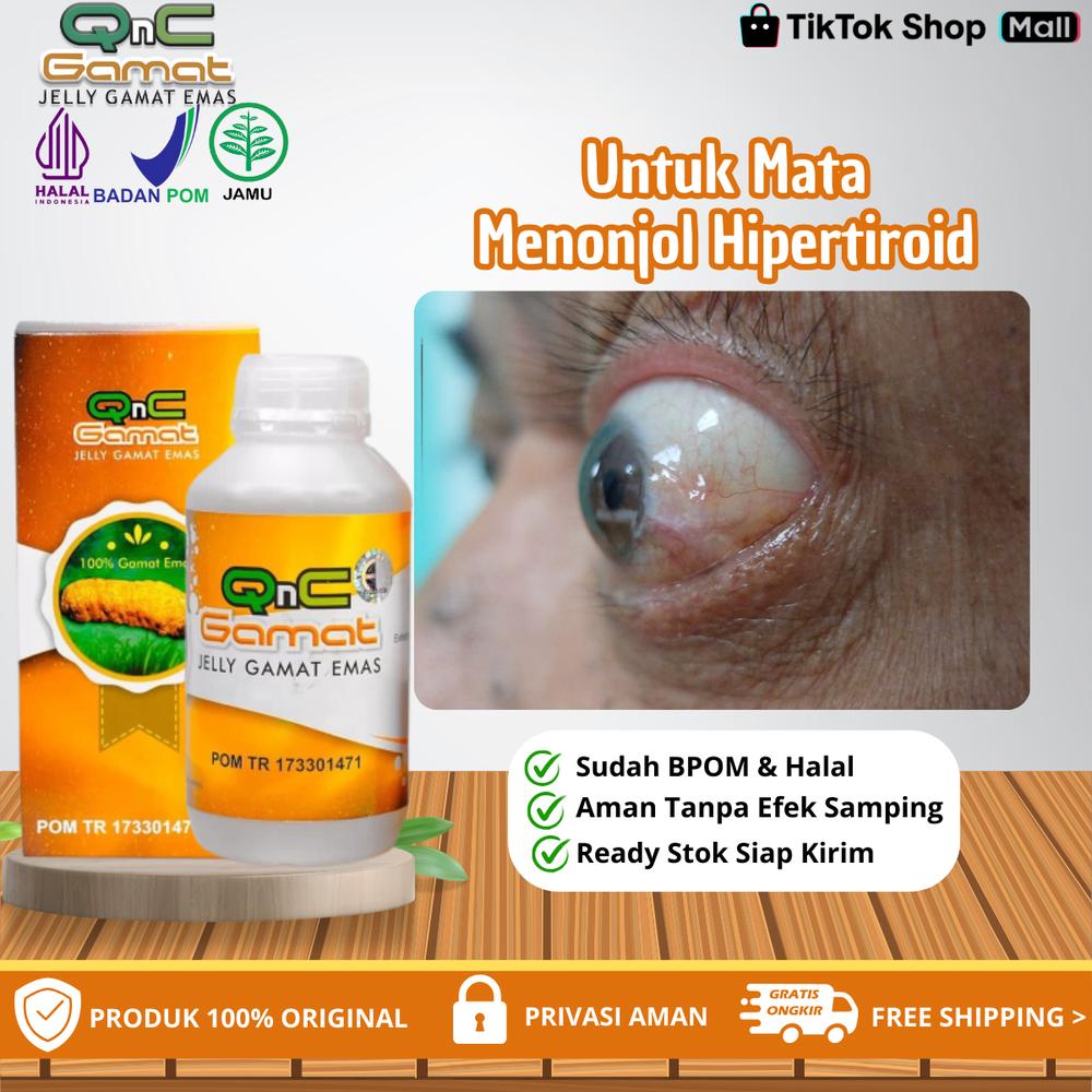 QnC Jelly Gamat Untuk Mata Menonjol Sebelah Hipertiroid, Kelenjar Tiroid Aktif