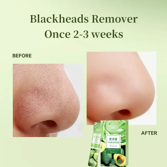 TWG Complex Sour Avocado Bubble Facial Mask - Masker Wajah dengan Busa Ekstrak Alpukat 5