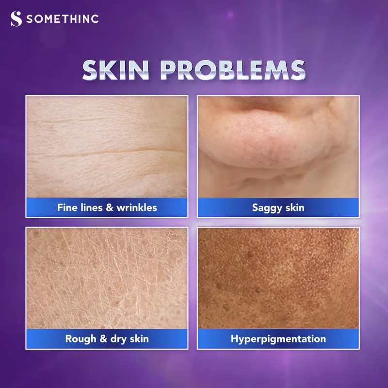 [PROMO TERBATAS] SOMETHINC SKINLIFT 1% Copper Peptide Resveratrol Serum GRATIS SERUM JARUM 2