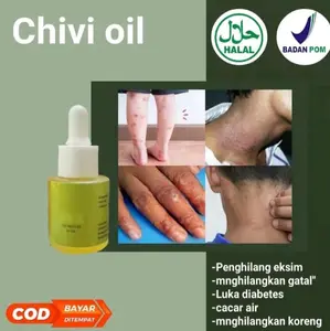 CHIVIOIL PENGHILANG BEKAS LUKA EKSIM DAN GATAL-GATAL