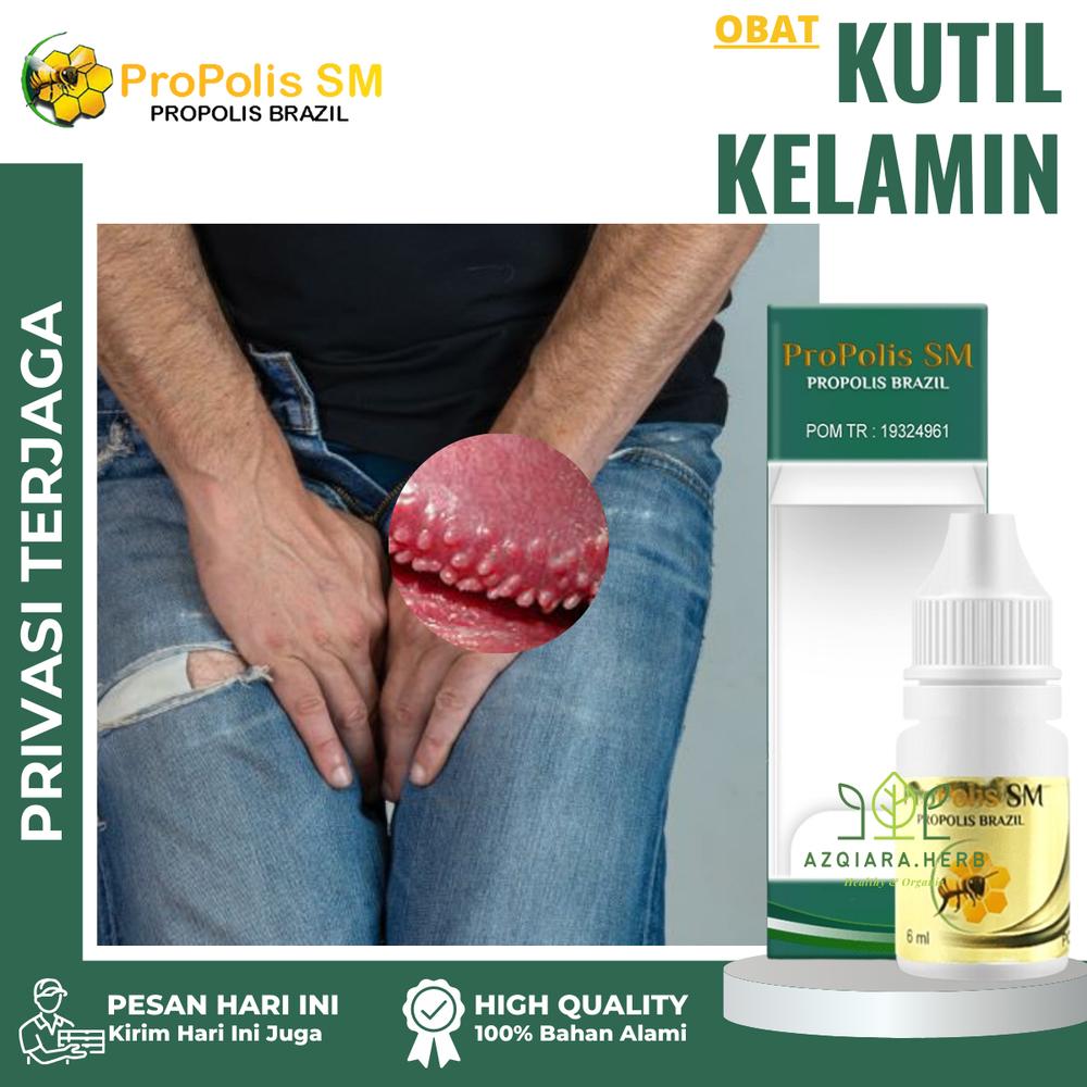 Salep Kutil Kelamin HPV Jengger ayam Penghilang Bintik Beruntusan Gatal Pada Kelamin Pria Dan Wanita Dengan Propolis Sm