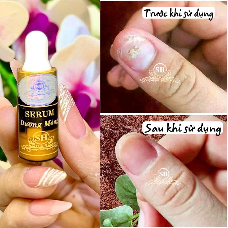 SH CHÍNH HÃNG SH Serum Trị Nấm Móng Bọng Móng Hư Tổn 4ml - Dưỡng Cứng Móng Tay Chân Đẹp Hơn