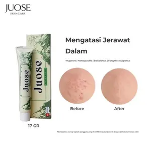 JUOSE Krim Gatal Anti Bakteri Acne Obat Jerawat Perawatan Treatment Wajah Berjerawat Beruntusan