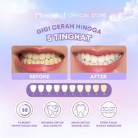 Gambar Moeloet Trial Sachet Whitening Purple Strip | Cerah tanpa Peroksida dari Moeloet Kota Bandung 3 Tokopedia