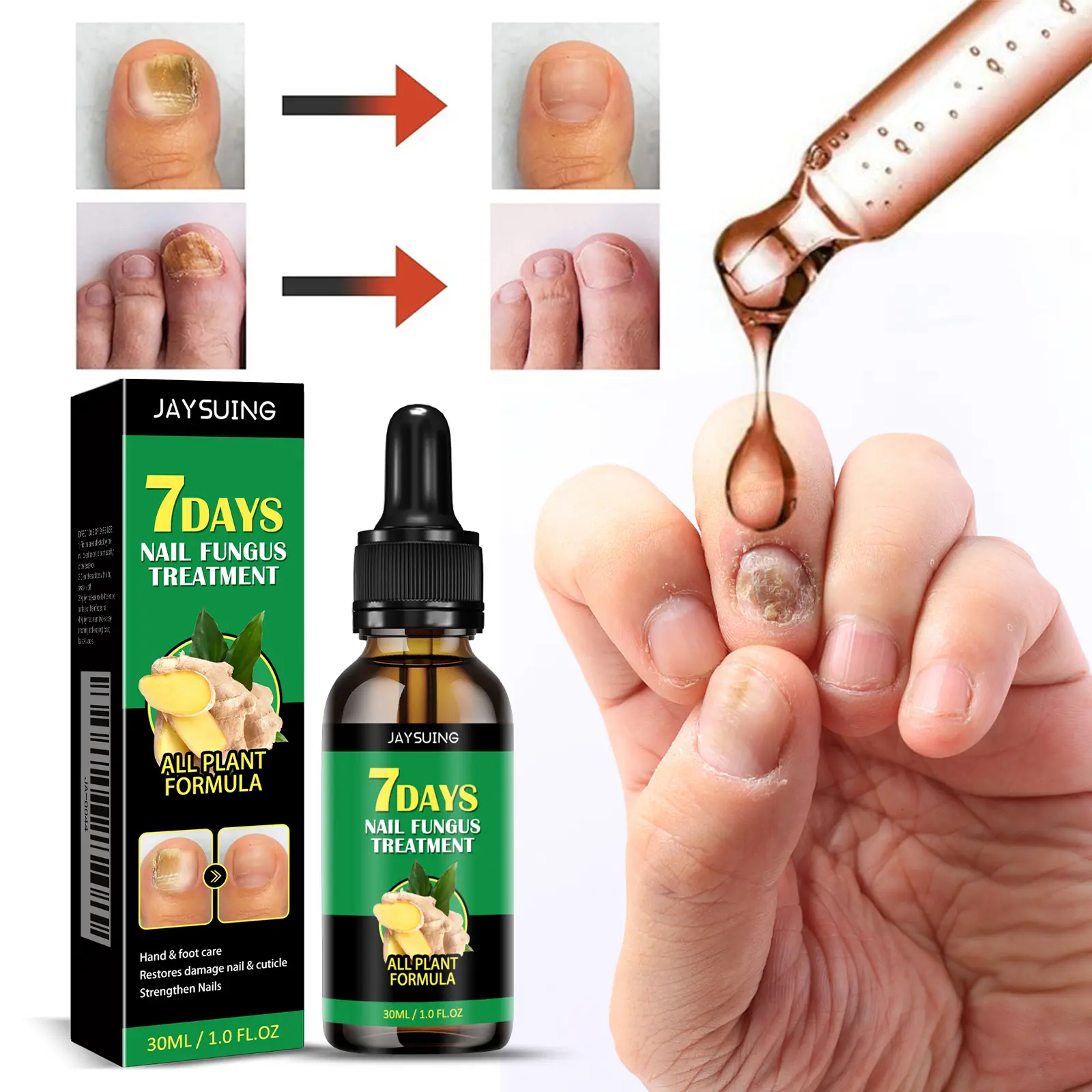 JAYSUING Tinh Dầu Gừng Dưỡng Móng Chân Tay - Giúp Phục Hồi Móng Hư Tổn, Ngăn Ngừa Nấm Móng - Dung Dịch Chăm Sóc Móng Khỏe Đẹp Tự Nhiên - 30ml