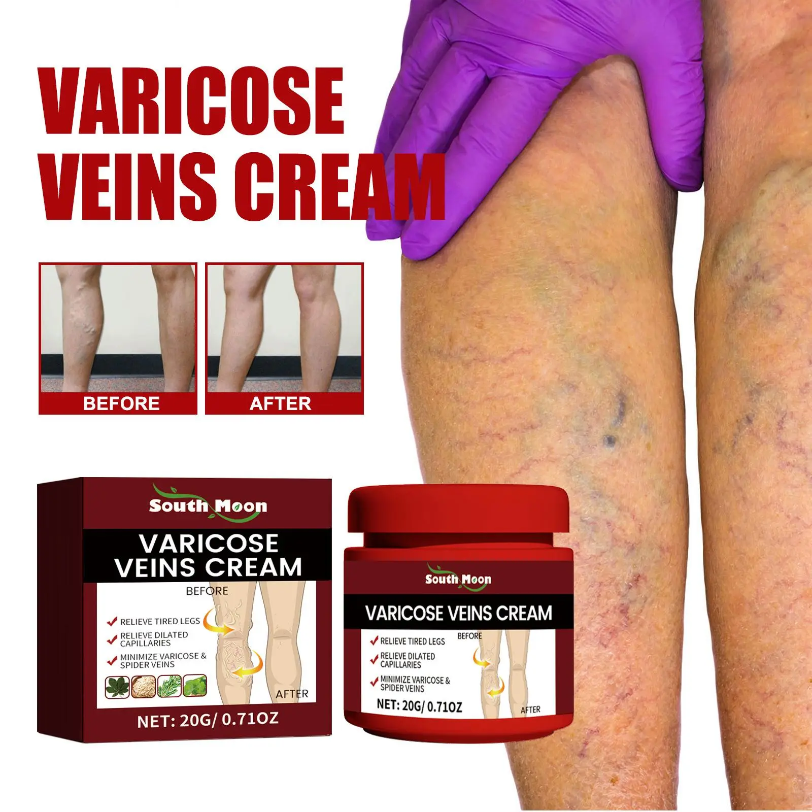 20g Cream for Varicose Veins, Cream for Varicose Veins Relief, Treatment of Varicose Veins for Legs, Improves Blood Circulation