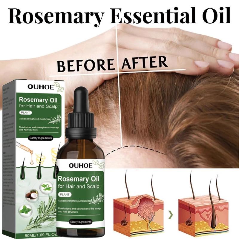 Product Introduction of Rosemary hair oil hair tonic penumbuh rambut dengan cepat dan botak tebal serum rambut rontok Hair growth serum Minyak 19