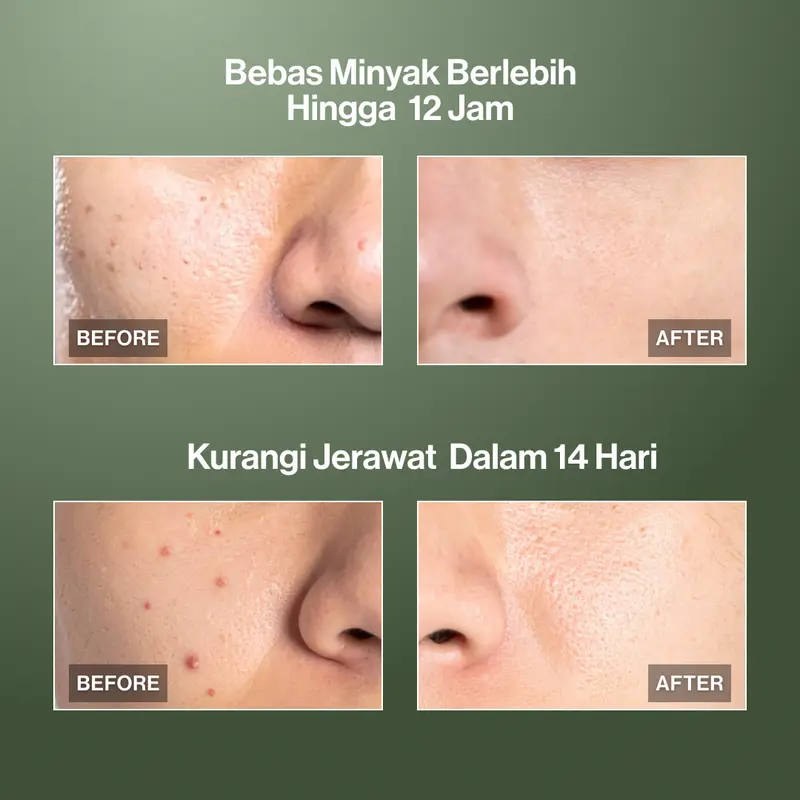 Kahf Face Wash Oil and Acne Care 100 ml - Sabun Cuci Muka Pria untuk Membantu Lawan Jerawat dan Kontrol Minyak - Suitable for Daily Use 4