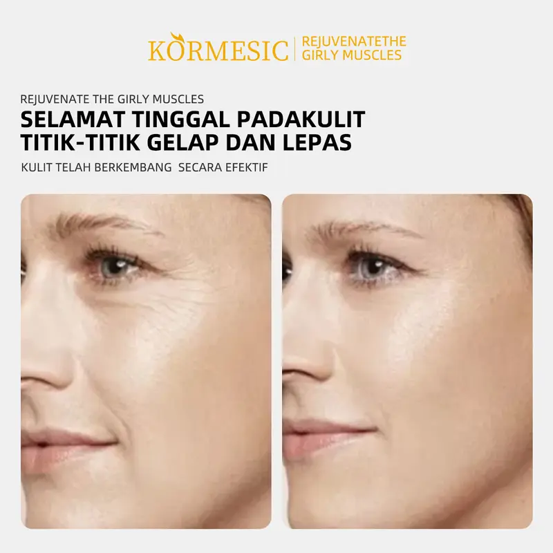 Sama seperti Michelle Ziudith  T1.「Beli 2 Dapat 3」BPOM-KORMESIC Serum Muka dengan Vitamin C + Kolagen untuk Mencerahkan dan Mengurangi Kerutan 30ml - Wajah Memudarkan Kering  Essence Hitam Perawatan Mengencangkan 5