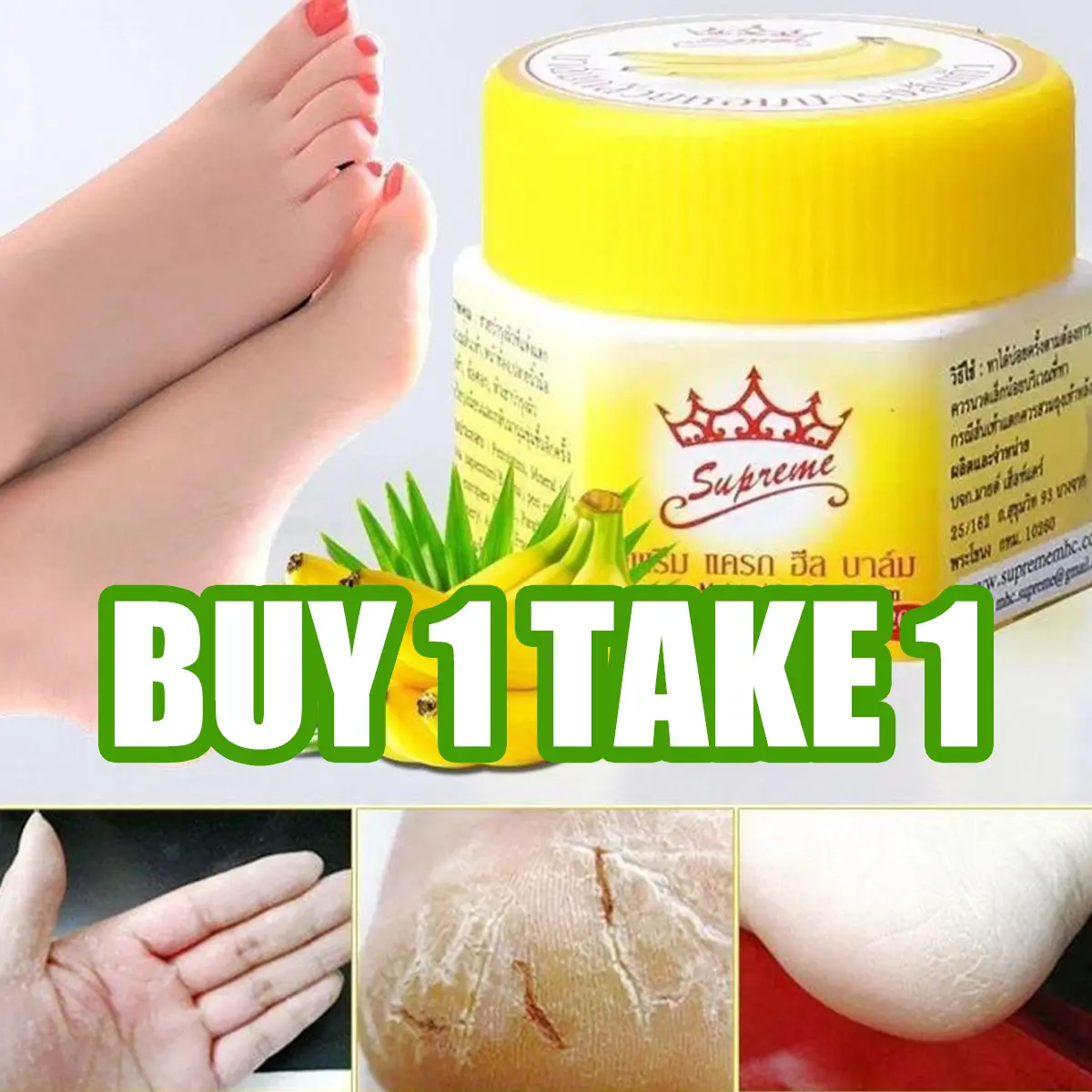 BUY 1 TAKE 1 BANANA HEEL CREAM CALLUSES Banana FootCare Balm Crack Relief Whitening Smooth SkinCreams