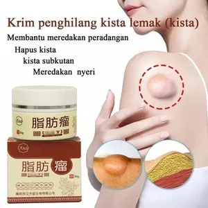 Lipoma Removal Cream Penghilang Kista & Lipoma Atasi Benjolan Lipoma Cepat Kempes Hilangkan Kista Lemak Kempes Tanpa Bedah