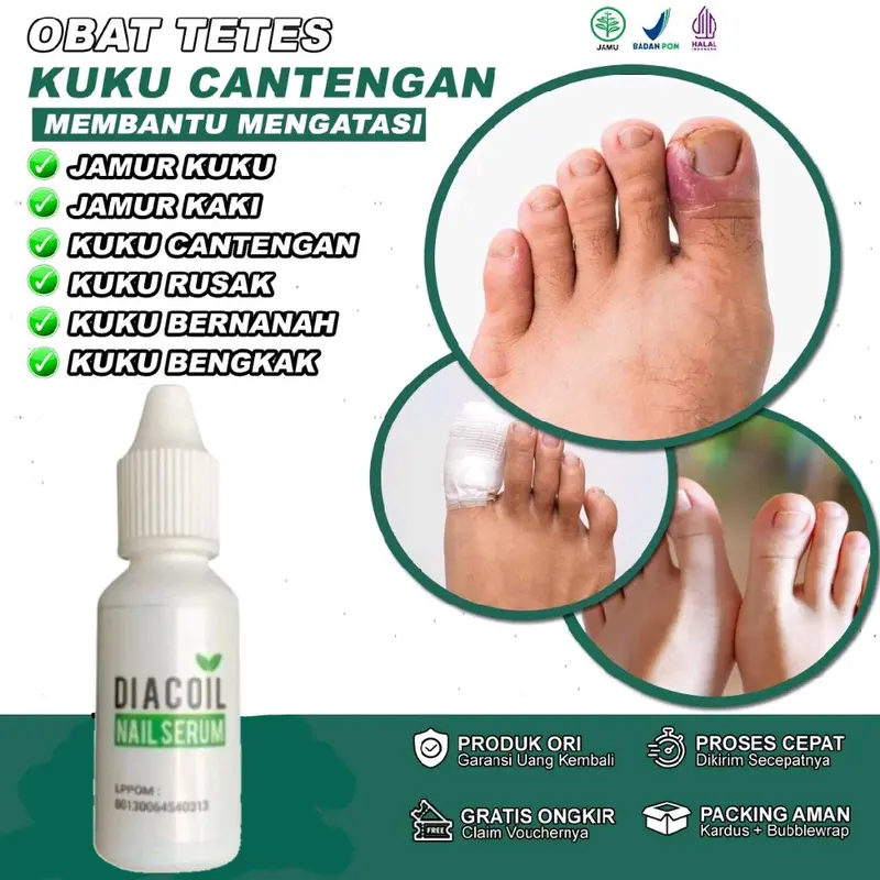 GARANSI ORIGINAL OBAT KUKU ATASI CANTENGAN JAMUR KUKU RUSAK DAN BENGKAK AMPUH 0