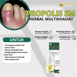 Propolis SM - Kuku Jamur Rusak, Kuku Bau Busuk, Kaki Rusak Cantengan Jempol Kaki, Psoriasis Kuku Kaki, Kuku Berjamur Dan Rusak, Kuku Bernanah