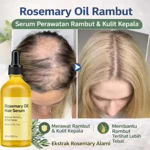 Rosemary oil Rambut penumbuh rambut cepat Serum penebal rambut cepat dan tebal Original Ampuh